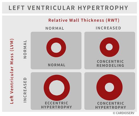 echocardiography vs lvh.